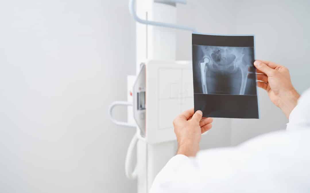 Où passer une radiographie sans rendez-vous ? Ce qu’il faut savoir