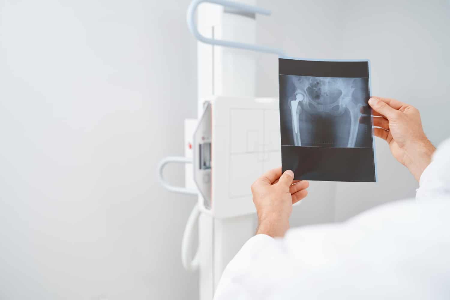 Où passer une radiographie sans rendez-vous ? Ce qu’il faut savoir